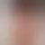 Profil av carinhiso