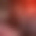 Chat med  edaiah2331487890